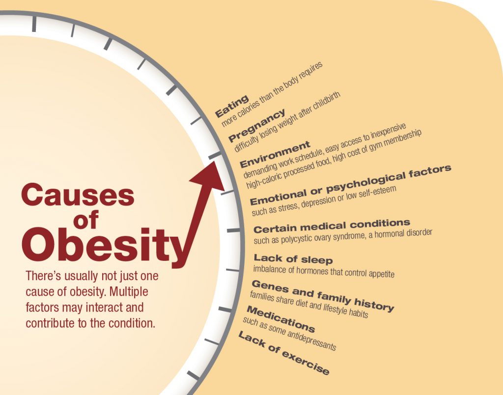 Obesity-causes